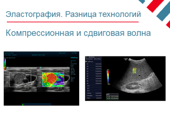Разница компрессионной и эластографией сдвиговой волны