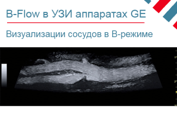 Технология B-Flow в УЗИ аппаратах GE