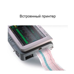 Фетальный монитор Comen STAR 5000 Фетальный монитор Comen STAR 5000