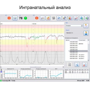 Фетальный монитор Сономед-250