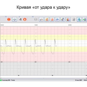 Фетальный монитор Сономед-250