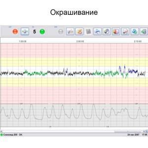 Фетальный монитор Сономед-250