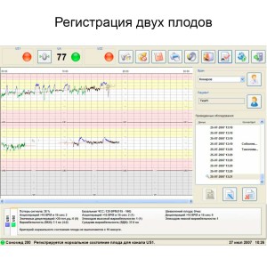 Фетальный монитор Сономед-250