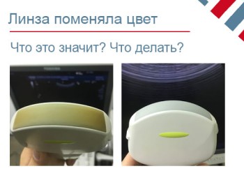 Линза УЗИ датчика потемнела (поменяла цвет)