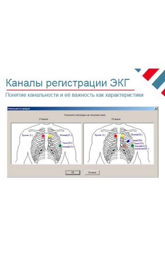 Количество каналов ЭКГ