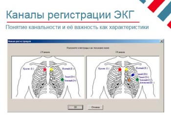 Количество каналов ЭКГ