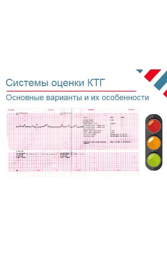 Системы оценки КТГ