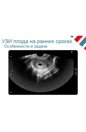 УЗИ на ранних сроках беременности