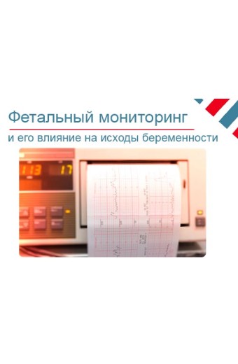 Как электронный фетальный мониторинг влияет на исходы беременности