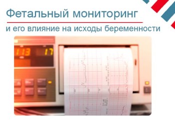Как электронный фетальный мониторинг влияет на исходы беременности
