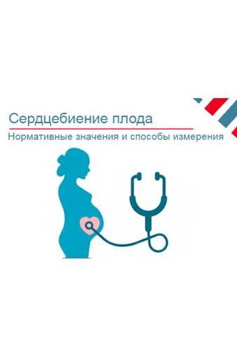 Сердцебиение плода