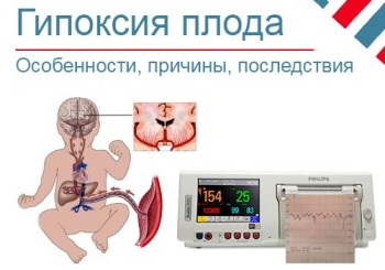 Гипоксия плода