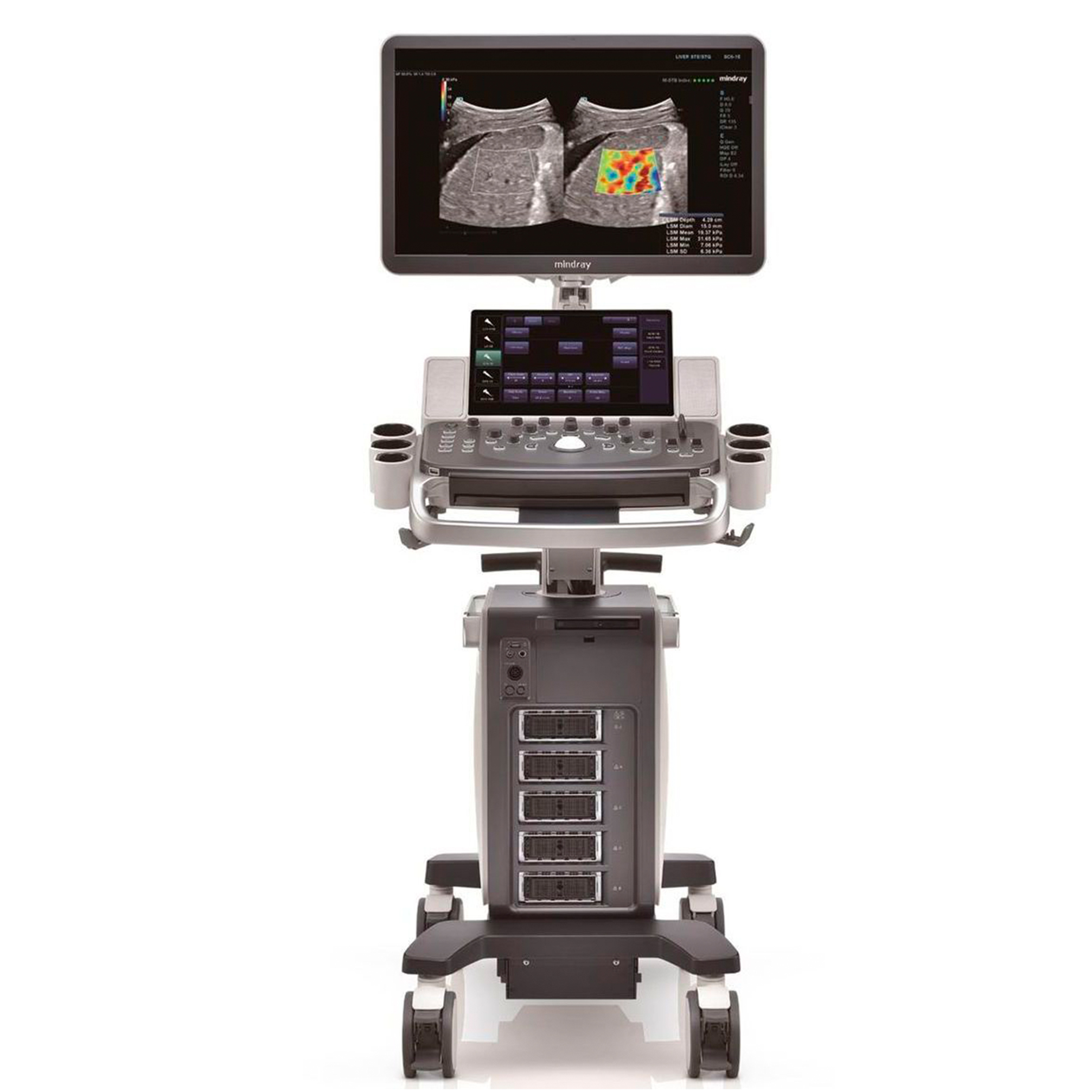 Mindray dc-80 x-insight. Dc 80. Dc 80. Mindray dc-80 x-insight. Dc-80 mindray.