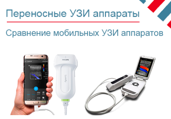Сравнение переносных УЗИ аппаратов