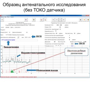 Фетальный монитор Уникос 01 Фетальный монитор Уникос 01