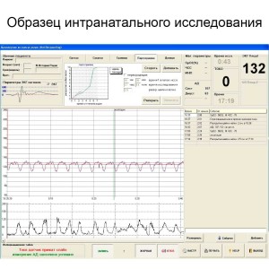 Фетальный монитор Уникос 01 Фетальный монитор Уникос 01