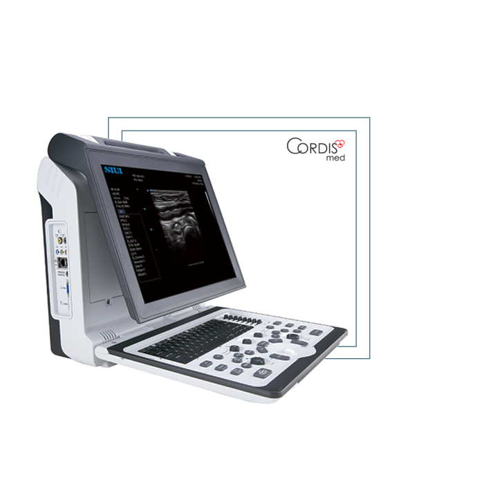 Купить УЗИ аппарат SIUI Apogee 2300V по низкой цене