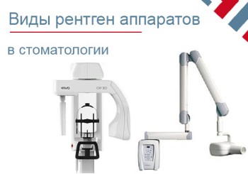 Стоматологическое рентген оборудование: виды, сервис и ремонт