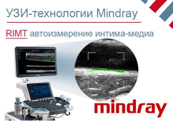 RIMT - улучшенное автоматическое измерение КИМ 