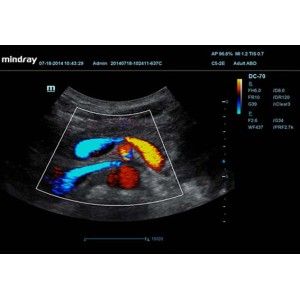 Mindray DC-70 Mindray DC-70