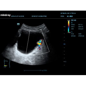 Mindray DC-55 Mindray DC-55