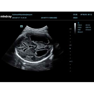 Mindray DC-70 Mindray DC-70