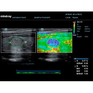 Mindray DC-70 Mindray DC-70