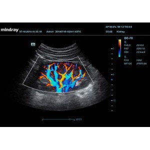Mindray DC-70 Mindray DC-70