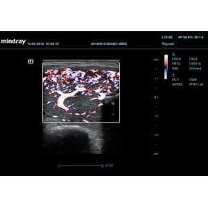 Mindray DC-70 Mindray DC-70