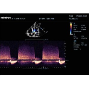 Mindray DC-70 Mindray DC-70