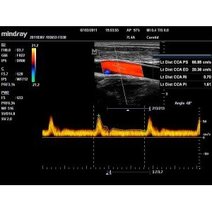Mindray DC-N6 Mindray DC-N6