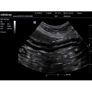 Mindray DC-T6 Mindray DC-T6