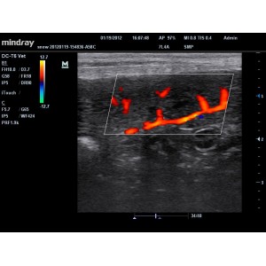 Mindray DC-T6 Mindray DC-T6