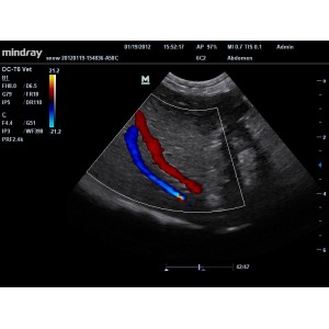 Mindray DC-T6 Mindray DC-T6