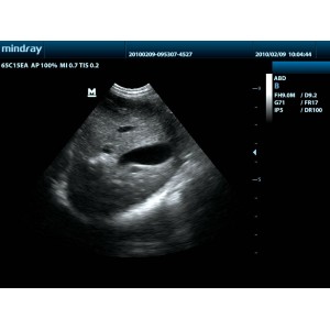 Mindray DP-50 Mindray DP-50