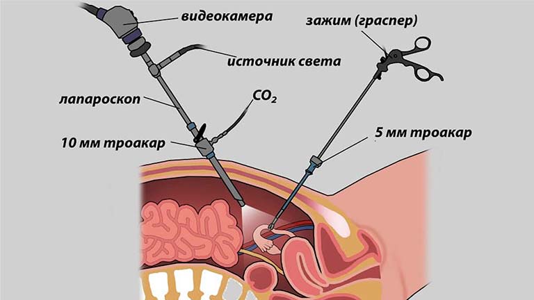 Эндоскопическое оборудование, виды, конструкция, особенности, цены