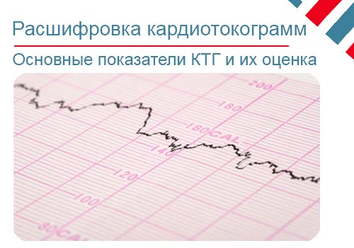 Расшифровка КТГ